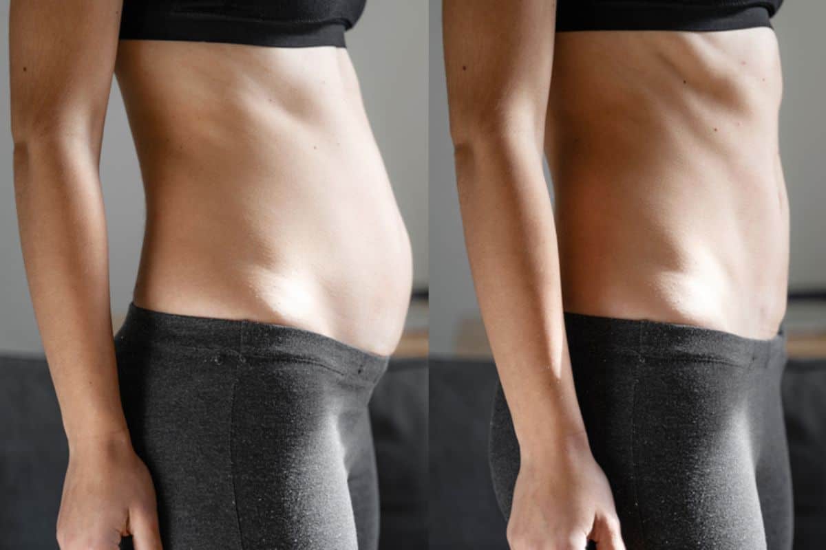 Post-Pregnancy: What Happens to Your Abdominal Muscles After Birth Bedfordshire