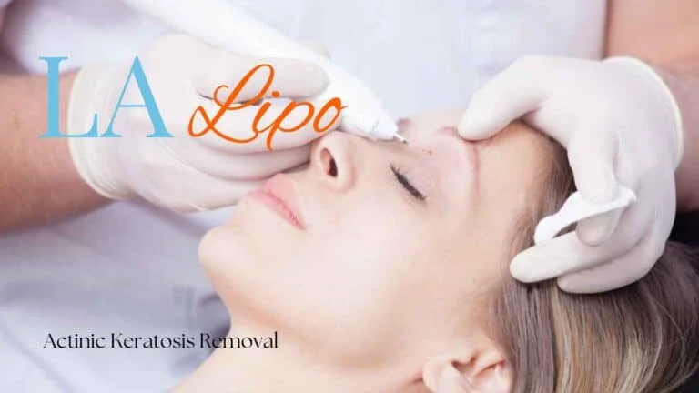 Woman receiving Actinic Keratosis Removal Treatment Bedfordshire