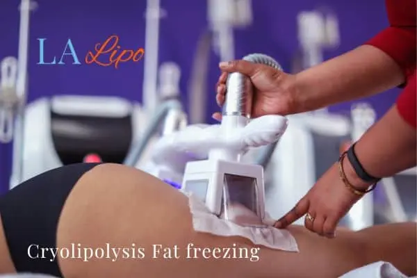 women getting fat freezing Bedfordshire