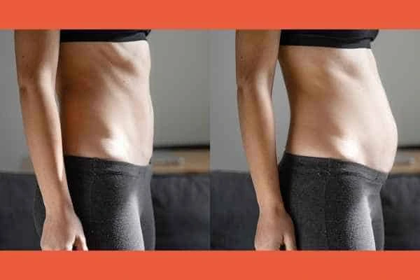 LA-EMS Body Sculpting results Bedfordshire