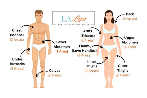 LA LIPO Cryolipolysis Areas Bedfordshire