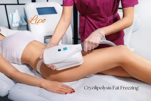 Woman receiving coolsculpting Bedfordshire treatment on her thighs