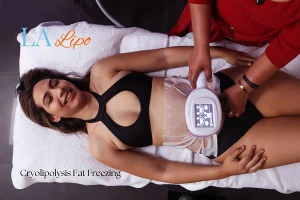 woman getting cryolipolysis Bedfordshire