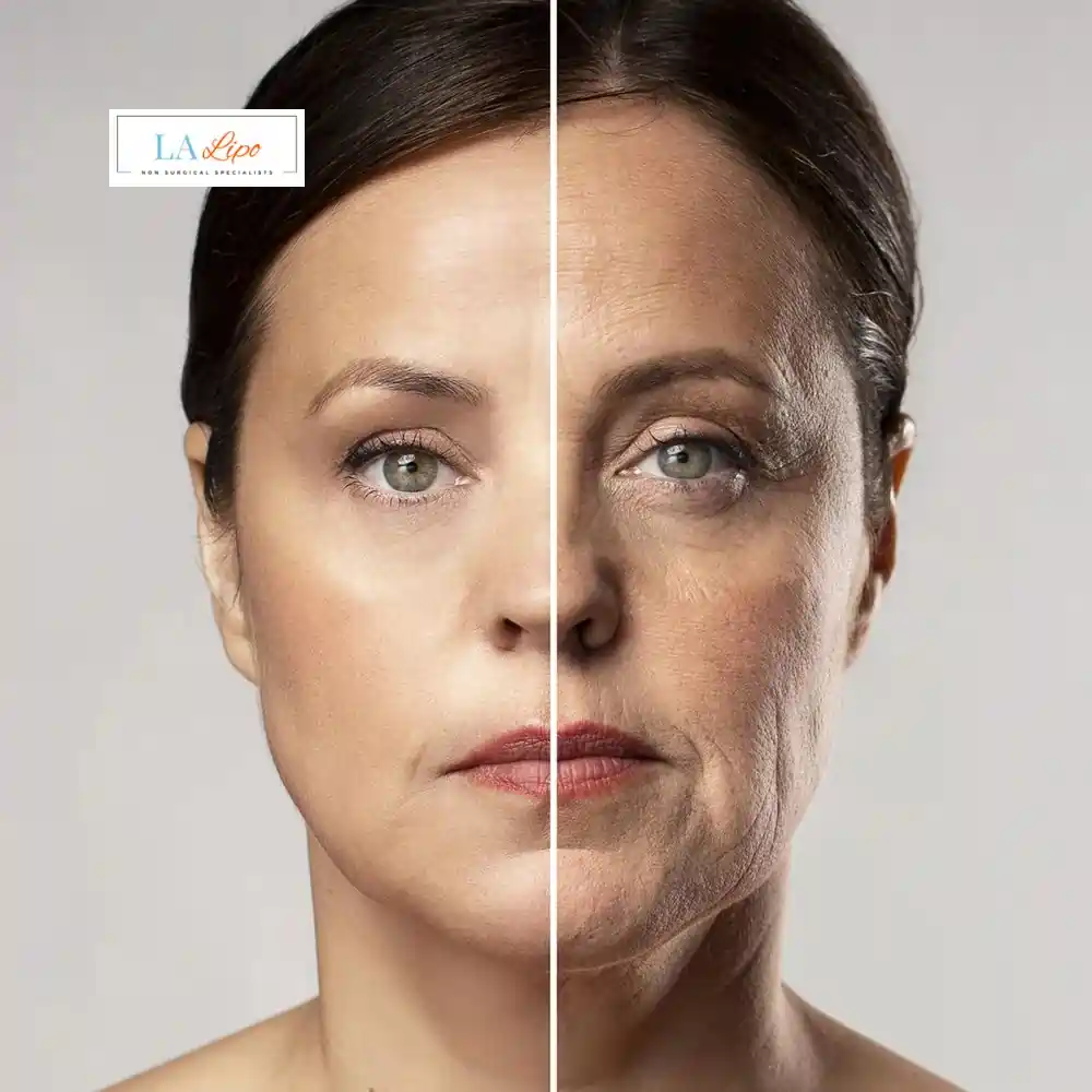 How Can You Tell If Non-Surgical Skin Tightening Is Right for You Bedfordshire?