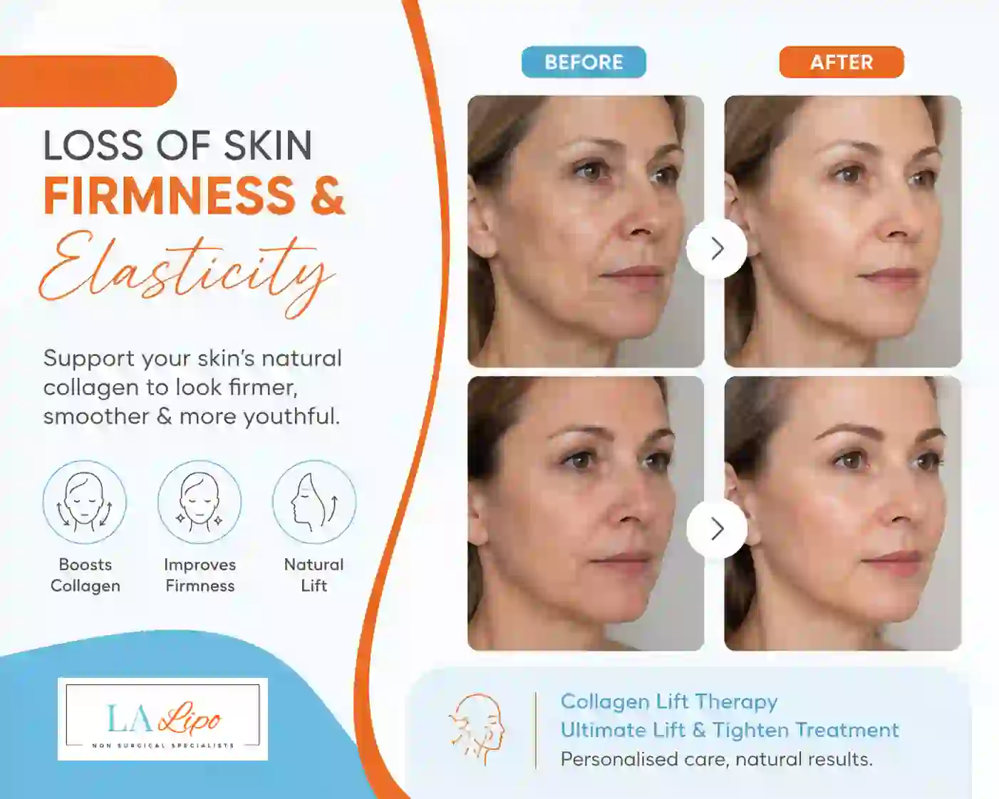 Sign #7: Loss of Skin Firmness and Elasticity Bedfordshire