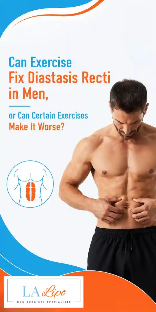 Can Exercise Fix Diastasis Recti in Men, or Can Certain Exercises Make It Worse Bedfordshire?